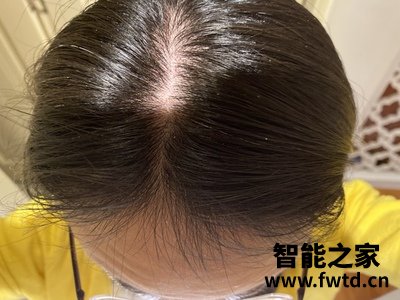 以色列veve blanc智能增发生发仪怎么样说一说体验心得感受? 