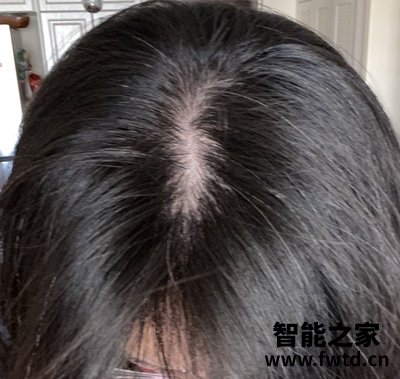 以色列veve blanc智能增发生发仪怎么样说一说体验心得感受? 