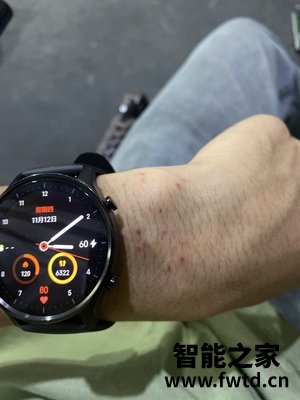 实话实说:手表redmi watch评测怎么样?这个真的好吗!使用优缺点 实话实说:手表redmi watch评测怎么样?这个真的好吗!使用优缺点