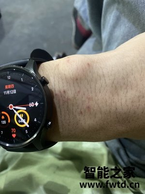 实话实说:手表redmi watch评测怎么样?这个真的好吗!使用优缺点 实话实说:手表redmi watch评测怎么样?这个真的好吗!使用优缺点